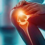 The Connection Between Hip and Knee Pain